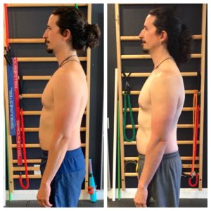 6 Moves to Fix Rounded Shoulders [FIX YOUR POSTURE]