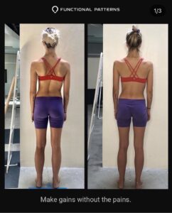 Now vs Then; Posture Results - SA Functional Fitness